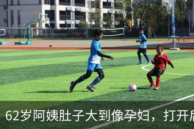 62岁阿姨肚子大到像孕妇，打开后吓坏了！巨物占满整个腹腔！深圳医生：随时大出血